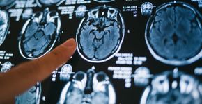 Foto: (iStock/Popartic)