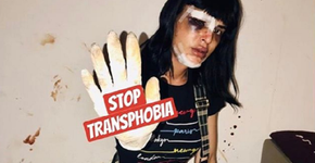 Modelo trans espancada reconhece agressor e recebe apoio de famosos