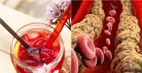 Foto: (SrdjanPav/istock/Naeblys/istock)