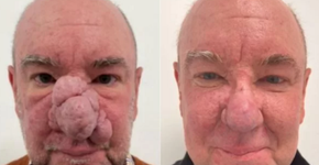 Foto: (reprodução/EverClinic)