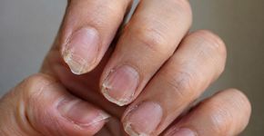 O erro acontece antes mesmo do esmalte: 5 hábitos que deixam as unhas fracas e descamando com frequência