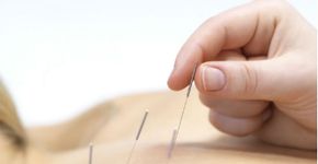 Saiba onde fazer tratamento de acupuntura pagando pouco