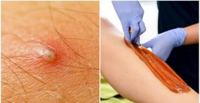 Foto: (iStock | pobladurafcg | dardespot)