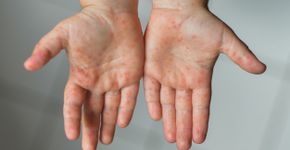 Foto: (kipgodi/istock)