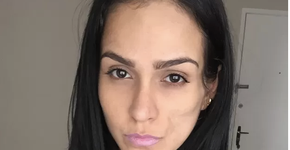 Modelo enfrenta doença rara e consegue ficar ainda mais bonita