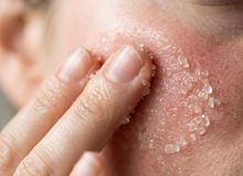 Featured side: Parece uma esfoliação natural e barata, mas o tamanho dos grãos pode mudar completamente o resultado