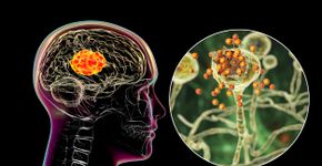 Foto: (Dr_Microbe/istock)