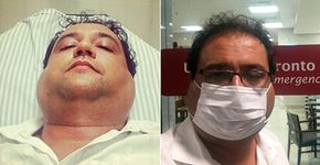 Geraldo Luiz vai parar no hospital com inchaço repentino no rosto
