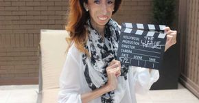 Lizzie Velasquez desabafa sobre memes que viralizaram na internet