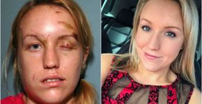 Mulher vítima de violência se casará com bombeiro que a salvou