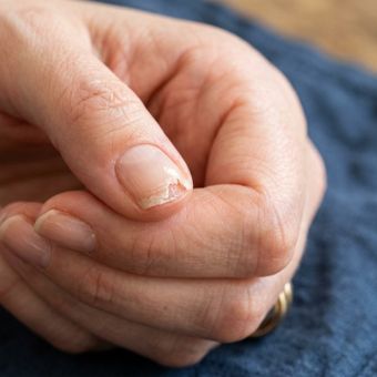 Featured mobile: A unha lasca sempre no mesmo canto e isso pode ter mais relação com a rotina das mãos do que com o esmalte usado