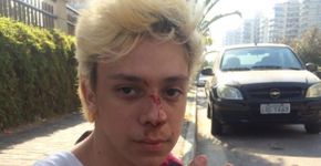 Youtuber Victor Meyniel é agredido por homofobia