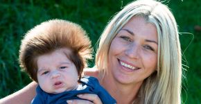 Lembra dele? Veja como está Cox, o ‘bebê mais cabeludo do mundo’