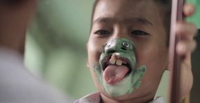 Ação devolve sorriso a crianças com deficiência