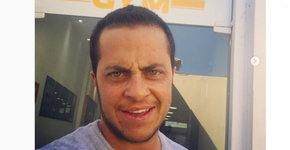 Thammy Miranda posta foto e internautas reparam em sua calvície