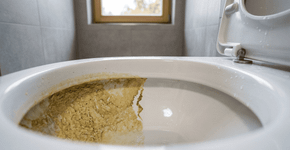 “Seu vaso sanitário não é encardido, ele apenas criou uma camada de calcário”: este é o truque para salvar seu vaso que nunca fica branco