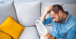 Calvície masculina: três tratamentos para lidar com a queda