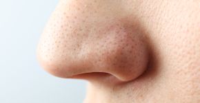 Foto: (Liliia Bila/istock)