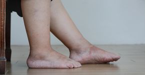 Foto: (Toa55/istock)