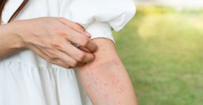 Alergia alimentar: Cientistas descobrem o que pode curar a doença