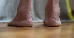 Foto: (Gabrijelagal/istock)