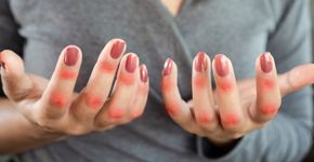 Foto: (iStock/Doucefleur)