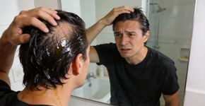 O que significa quando o cabelo começa a ficar oleoso do nada?