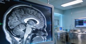Seu cérebro muda completamente quatro vezes na vida nessas idades