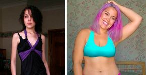 Blogueira que venceu a anorexia inspira o amor pelo nosso corpo