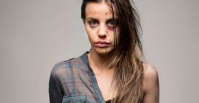 Fotógrafo mostra o efeito das drogas