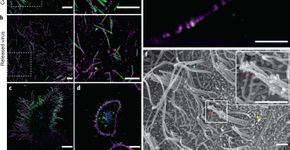 Foto: (divulgação/Nature Microbiology)