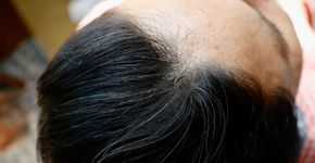 Foto: (iStock/Yusuke Ide)