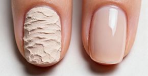 A melhor base para corrigir ondulações e falhas nas unhas