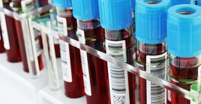 Novo exame de sangue detecta autismo com 88% de precisão