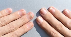 Foto: (Tatiana Terekhina/istock)