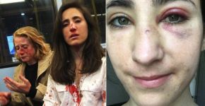Polícia de Londres detém jovens acusados de espancar casal gay