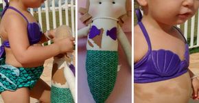 Mãe faz boneca com manchas para filha: ‘ela se viu representada’