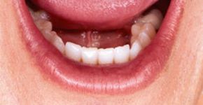 Faculdades oferecem tratamento dentário