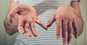 Foto: (Istock/Lolostock)