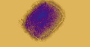 Foto: (Science Photo Library)