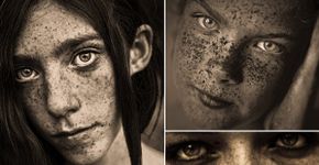 Fotógrafo faz série de retratos de pessoas com sardas
