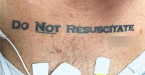 Paciente tatua ‘não ressuscitar’ no peito e levanta debate