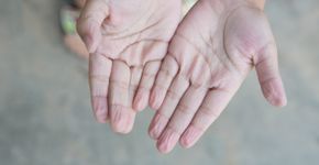 Foto: (andy_Q/istock)