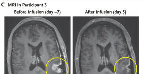 Foto: (reprodução/The Journal of Neuroscience,)