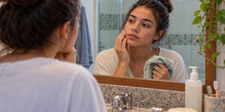 Featured main: Pele cheia de espinhas? Dermatologistas destacam um hábito diário que muitos jovens acabam deixando de lado