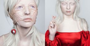 Conheça Nastya Zhidkova, a albina mais linda do mundo