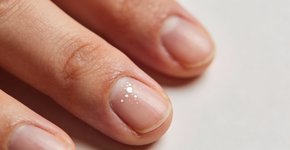 O que significa quando aparecem manchas brancas nas unhas?