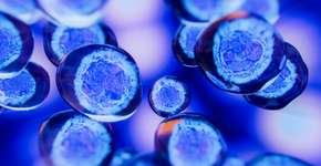 Foto: (Maksim Tkachenko/istock)