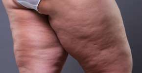 Foto: (Staras/istock)