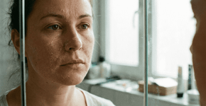 O que significa a pele descamando? alergia a cosméticos ou apenas clima seco?